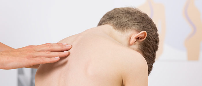 Chiropractic Care in Calgary For Scoliosis Relief